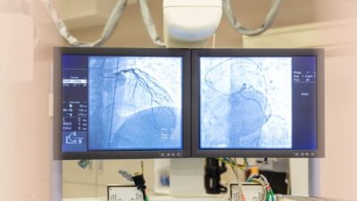 Kenali Jantung Anda dengan Baik di Pantai Hospital Melaka