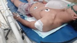 Karyawan perusahaan elektronik di Batam menjadi korban penusukan yang diduga dilakukan genk motor di Batam Kota. Korban mengalami tujuh luka tusuk dan kini menjalani perawatan intensif.