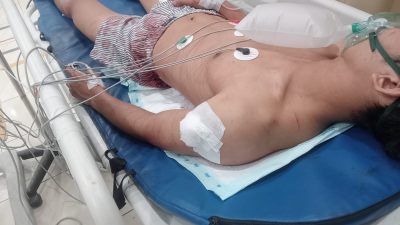 BATAM SEMAKIN MENAKUTKAN! KARYAWAN DITUSUK GENG MOTOR DI PESONA ASRI